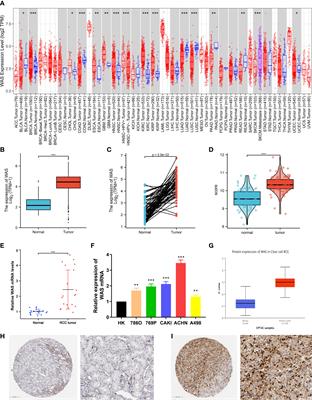 Wiskott-Aldrich syndrome gene as a prognostic biomarker correlated with immune infiltrates in clear cell renal cell carcinoma